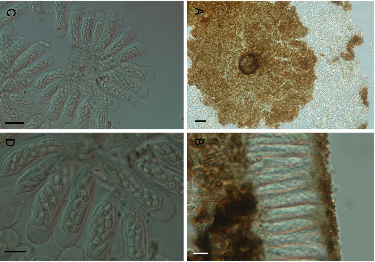 Представитель Семейства Phillipsiellaceae